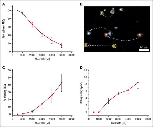 Rolling adhesion of HbSS RBCs onto immobilized ICAM-1 under flow conditions. The data shown are the mean percentages of adherent or rolling RBCs onto immobilized ICAM-1 and the mean rolling velocities under shear rates of 500, 1000, 2000, 3000, 4000, and 5000 s−1. A mean of 100% of HbSS RBCs adhered to immobilized ICAM-1 (including rolling adhesion and firm adhesion). (A) The number of adherent RBCs to immobilized ICAM-1 decreased with increasing shear rates. Shown are mean percentages of adherent RBCs (n = 5). (B) Two overlapped frames, taken 1 second apart, extracted from a video depicting cell rolling behavior. (C) The number of rolling RBCs increased with increasing shear rates (n = 5). (D) The velocities of rolling RBCs on immobilized ICAM-1 increased with increasing shear rates (n = 5). Error bars represent ± SEM.