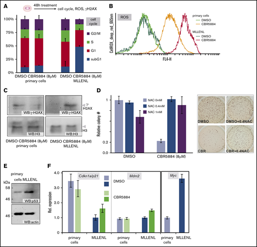Inhibition of Ser synthesis causes cellular stress in leukemic cells (A) Cell cycle distribution of normal and leukemic HSPCs after a 48-hour block of Ser biosynthesis. Shown are means and standard deviations of 3 independent experiments. Cell cycle phases are colored as indicated. (B) Cellular ROS in cells treated as in panel A. The cells were stained with CellROX deep red reagent and evaluated by FACS. A representative example of 2 experiments is depicted. (C) DNA damage after Ser synthesis blockade. Nuclear proteins were extracted from cells treated as before and immunoblotted with antibodies against the damage-specific histone derivative γ-H2AX and for histone H3 as the control. (D) ROS quenching restores CFC activity after CBR5884 treatment. MLL-ENL–transformed cells were incubated for 48 hours with 8 µM CBR5884 and either solvent or the indicated concentrations of the ROS-quencher NAC. The number of CFCs was recorded in triplicate experiments, with results depicted as mean and standard deviation. An example of the CFC assay is shown in the right panel. DMSO (left columns) difference between NAC 0 mM to 0.4 mM is not significant; difference between 0 mM and 1 mM NAC is P = .03. CBR5884 (right columns) difference between 0 mM and 0.4 mM NAC is P = .00002; difference between 0 mM and 1 mM NAC is P = .002. (E) Steady state levels of p53 in normal and leukemic HSPCs, as detected by western blot. (F) Blunted p53 response in leukemic cells. Expression levels of the major p53 target genes Cdkn1a/p21 and Mdm2, as well as those of the p53 antagonist Myc were determined by qPCR in normal and leukemic HSPCs, in steady state and after CBR5884 treatment.