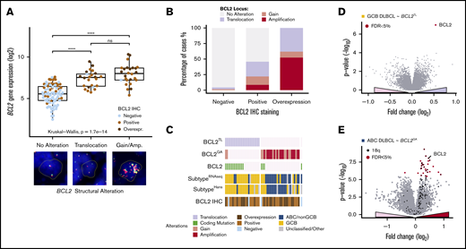 Structural variations of BCL2 specifically increase BCL2 expression in a subtype-dependent manner. (A) Box plot demonstrating the association of BCL2 gene expression with structural variations of BCL2 locus. Protein expression demonstrated with dot colors. Representative cases of the cytogenic alterations (FISH) are shown below the plot. (A-D) Break-apart positive cases by FISH with concurrent copy number alterations regraded BCL2TL. (B) Association of BCL2 immunoreactivity with underlying structural variations. (C) Oncoprints of BCL2 alterations demonstrating mutually exclusive nature of BCL2TL and BCL2GA. Coding single-nucleotide variations (SNVs) of BCL2 were cooccurring with BCL2TL (Fisher’s exact, P = 8.5E-5). Interestingly, patients with cooccurring BCL2GA and BCL2 SNVs represented GCB subtype. (D-E) Volcano plots demonstrating the differentially expressed genes between BCL2 altered and other tumors within the RNA sequencing-based molecular subtypes. BCL2 alteration associated genes shown with a positive fold change. (D) BCL2TL within GCB DLBCLs. (E) BCL2GA within ABC DLBCLs. Most of the BCL2GA-associated upregulated genes resided in the vicinity of BCL2 in 18q locus (black dots). ****P < .0001. ns, not significant.