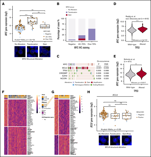 Translocations of MYC recognize a phenotype with distinctive mutational landscape and gene expression profile and structural variations of BCL6 are not associated with gene or protein expression. (A) Box plot of the impact of MYC structural variations with MYC gene and protein expression. Representative cases of the alterations (FISH) shown below the box plot. Concurrent MYCTL and MYCGA regarded as MYCTL in analyzes. (B) Bar plot representing the frequencies of MYC structural variations with MYC immunoreactivity. (C) Oncoprint of concurrent genomic alterations with MYCTL. Fisher’s exact, P < .05. Multiple testing corrected for genes mutated in >5 patients of the study cohort with complete cytogenetic data. MYC SNVs were only detected in MYCTL DLBCLs. (D-E) Violin plots demonstrating different MYC gene expression levels between TP53 wild-type and TP53-altered DLBCLs in independent datasets. (D) Reddy et al cohort excluding discovery cohort. (E) Schmitz et al cohort. (F-G) Heatmaps of the differentially expressed genes according to MYCTL within the whole cohort (F) and within the GCB DLBCLs (G). Red asterisk and bold denotes genes reported important for the DHIT signature by Ennishi et al. Genes with FDR <10% and fold-change (log2 transformed) >0.25 included in the heatmaps. (H) Box plot demonstrating the similar levels of gene expression between different structural alterations of BCL6. Representative cases of BCL6 SVs detected with FISH below the plot. Dot colors indicate IHC staining positivity. Concurrent BCL6TL and BCL6GA regarded as BCL6TL. **P < .01; ****P < .0001.