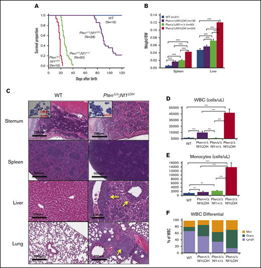 Correlation of phenotype and genotype in the dual-age–specific leukemia mouse model. (A) Kaplan-Meier survival curves show the relationship between survival time and genotype (P < .001). Death was counted in mice without any intervention. Male/female ratios were 2:1 in PtenΔ/ΔNf1LOH mice and Pten+/ΔNf1LOH mice and 1:1 in PtenΔ/ΔNf1+/Δ mice and WT mice. (B) Relationship between the genotype and the spleen and liver weights. Organs from littermates were collected at PND17-19 when PtenΔ/ΔNf1LOH mice with JMML were moribund. Data are presented as median ratios of spleen or liver weight/body weight (BW). (C) Representative photomicrographs of hematoxylin and eosin–stained tissue sections from PtenΔ/ΔNf1LOH mice with JMML (right panels) and WT control littermates (left panels) at PND18. Infiltrates are indicated by yellow arrows. (D-I) Blood profiles from juvenile PtenΔ/ΔNf1LOH mice and littermates at PND17-19 when diseased mice were moribund (n = 12-21). Complete blood counts were performed with a Vet Abc Hematological analyzer. Differentials were manually counted from blood smears stained with May-Grünwald-Giemsa. (J-O) Flow cytometry analysis of cell subpopulations in BM, PB, and spleen. Data are mean ± standard error. *P < .05, ** P <.01, ***P < .001. See additional supportive data in supplemental Figures 1-7. Granu, granulocytes; HGB, hemoglobin; Lymph, lymphocytes; Mon, monocytes; PLT, platelets; RBC, red blood cells.