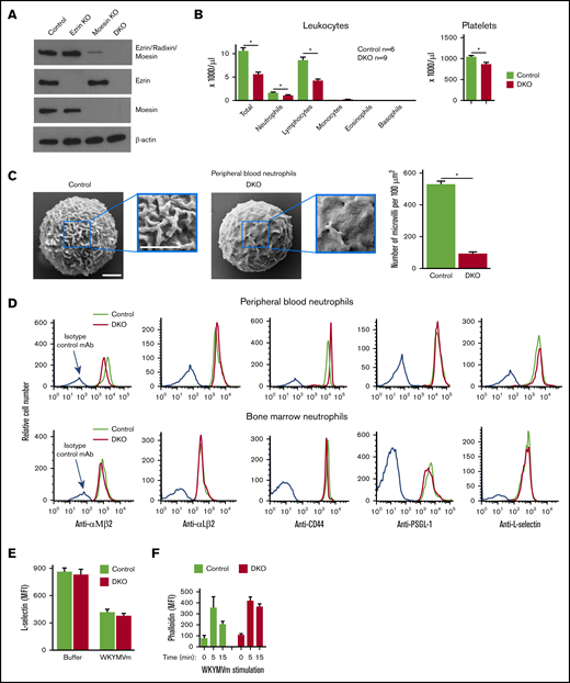 Characterization of ERM-deficient neutrophils. (A) Western blot of bone marrow neutrophils from the indicated genotype, probed with antibodies that recognize all 3 ERMs equivalently (top row), ezrin only (second row), moesin only (third row), or the control protein β-actin (bottom row). The data are representative of 3 experiments. Quantitative data are presented in supplemental Figure 1. (B) Leukocyte and platelet numbers from peripheral blood of control or DKO mice. The data represent the mean ± SEM from 6 to 9 experiments. (C) Left and middle panels, scanning electron micrographs of peripheral blood neutrophils from control and DKO mice. The boxed areas are magnified in the insets. Scale bar, 1 μm. Right panel, quantification of microvilli. The data represent the mean ± SEM from 32 to 35 neutrophils from 4 mice of each genotype. (D) Flow cytometric analysis of neutrophils from peripheral blood or bone marrow from the indicated genotype, probed with antibodies to the indicated protein. The data are representative of 5 experiments. Quantification of the data as mean fluorescence intensity is presented in supplemental Figure 2. (E) Flow cytometric analysis of L-selectin expression on bone marrow neutrophils of the indicated genotype 15 minutes after incubation with buffer or WKYMVm peptide. The data represent the mean ± standard deviation from 3 experiments. (F) Flow cytometric analysis of phalloidin binding to polymerized actin in permeabilized bone marrow neutrophils of the indicated genotype at the indicated times after stimulation with WKYMVn peptide. The data represent the mean ± SEM from 5 mice per genotype. *P < .05. MFI, mean fluorescence intensity.