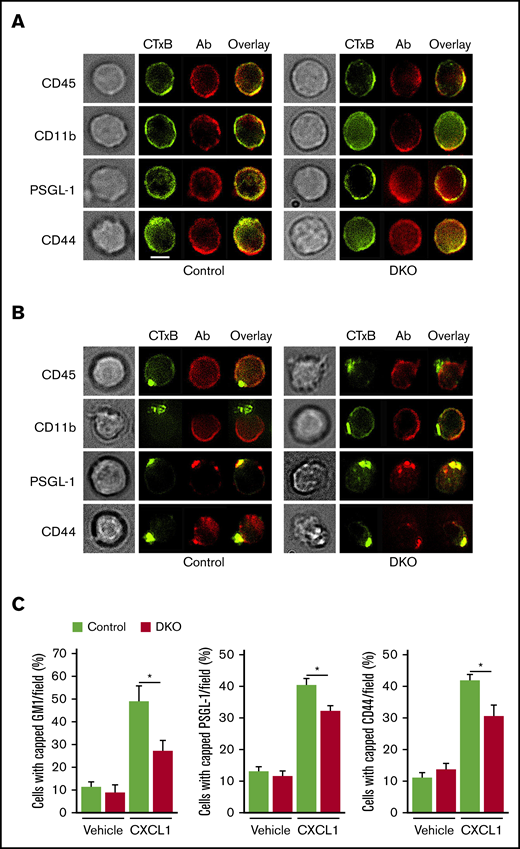 Neutrophils lacking ERMs polarize and redistribute raft-associated proteins to uropods. (A) Bone marrow neutrophils from control or DKO mice were fixed and labeled with CTxB to label GM1 (green) or with antibodies to the indicated protein (red). Representative cells were visualized by phase-contrast microscopy or confocal microscopy. Scale bar, 5 μm. (B) Neutrophils from control or DKO mice were stimulated with CXCL1, fixed, labeled, and visualized as in panel A. The data in panels A and B are representative of 3 experiments. (C) Percentage of vehicle- or CXCL1-treated neutrophils with capped GM1 (recognized by CTxB), PSGL-1, or CD44 visualized by confocal microscopy. The data represent the mean ± standard deviation from 3 experiments. *P < .05.