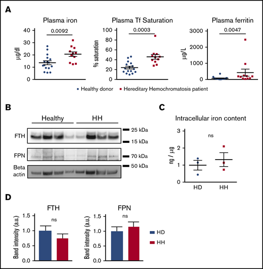 Neutrophils from HH patients are not iron loaded. (A) Plasma iron, transferrin (Tf) saturation, and ferritin in healthy donors (n = 16) and HH patients (n = 11). (B) Western blot of FPN, FTH, and β-actin on total protein extracts from neutrophils isolated from healthy donors and HH patients. (C) Neutrophil intracellular iron content quantification by atomic absorption (ETAAS) normalized by sodium content in healthy donors (n = 3) versus HH patients (n = 3). (D) Western blot band intensity quantification for FPN and FTH normalized by the healthy donor mean band intensity and expressed in arbitrary units. All results are shown as mean ± SEM. ns, not significant.