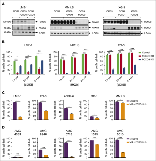 AKT prevents FOXO1- or FOXO3-induced cell death of MM cells. (A) Immunoblot analysis of CRISPR/Cas9–generated FOXO1 and FOXO3 knockout clones of the LME-1 (n = 2), MM1.S (n = 4), and XG-3 (n = 4) HMCLs. β-actin was used as loading control. (B) AKT inhibitor–induced cell death is dependent on the presence of FOXO1 in LME-1 and on FOXO3 in MM1.S and XG-3. Cloned knockout and control HMCLs were treated for 3 days with various concentrations of the MK2206 AKT inhibitor. Two to 4 independently established clones were analyzed per condition. Red bars depict FOXO1 knockout clones; blue bars depict FOXO3 knockout clones. Mean ± standard error of the mean (SEM) of 3 independent experiments are shown (**P < .01, ***P < .001, ****P < .0001; 1-way analysis of variance with Dunnett’s multiple comparison test). (C) AKT inhibitor–induced cell death in HMCLs can be rescued by FOXO1 inhibition (n = 5). HMCLs were treated for 3 days with 3.2 μM MK2206 AKT inhibitor, with (orange bars) or without (purple bars) 100 nM of the FOXO1 inhibitor AS1842856. Mean ± SEM of 3 independent experiments are shown (*P < .05, **P < .01, ***P < .001, ****P < .0001; unpaired Student t test with Welch’s correction). (D) Cell death of primary MM patient plasma cells induced by AKT inhibitor MK2206 (2.5 μM) can be overcome by the FOXO1 inhibitor AS1842856 (n = 5). Cells were treated for 3 days with 3.2 μM MK2206 AKT inhibitor, with (orange bars) or without (purple bars) 100 nM of the FOXO1 inhibitor AS1842856. Mean ± SEM of 3 technical replicates are shown (***P < .001, ****P < .0001; unpaired Student t test with Welch’s correction). Specific cell death in these experiments was determined by 7-AAD viability dye staining and flow cytometry. ns, not significant.