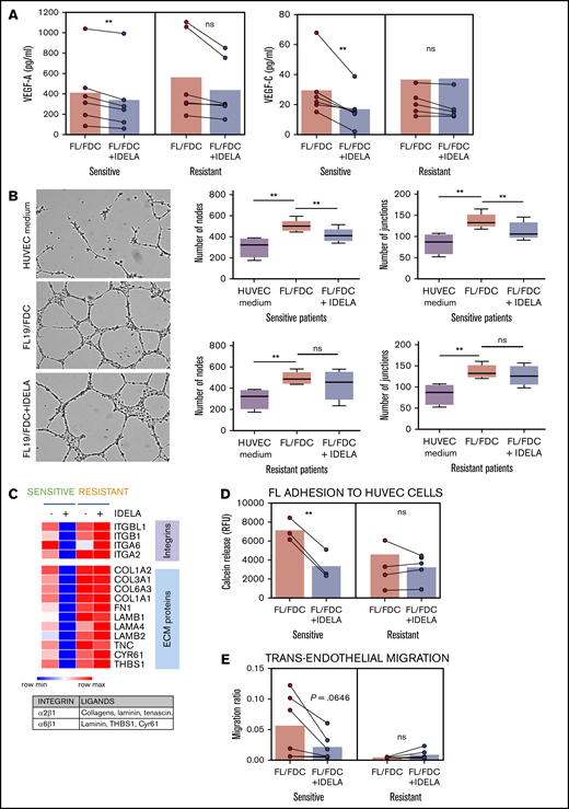 Idelalisib reduces FDC-induced angiogenesis and TEM in sensitive patients. FL-FDC coculture supernatants with or without idelalisib (IDELA, 500 nM, 48 hours) were used to determine VEGF-A and VEGF-C protein secretion by ELISA in sensitive (n = 6) and resistant (n = 6) patients (A) and tube formation assay of endothelial HUVEC cells cultured for 24 hours with their own media alone or mixed with the corresponding supernatants (ratio 1:1) (B) (magnification ×40). Five representative images of each condition were captured using a phase-contrast microscope and analyzed by FIJI-ImageJ (angiogenesis analyzer plug-in). Representative images from a sensitive patient are shown. Node and junction numbers from sensitive (n = 5) and resistant (n = 5) patients are displayed. (C) Heatmap displaying the regulation induced by idelalisib (IDELA) in the expression of integrins and their ligands in FL cells from FL-FDC cocultures of sensitive (FL1 and FL4) and resistant patient samples (FL2 and FL3). (D) After IDELA treatment (500 nM, 48 hours) FL cells from FL-FDC cocultures with or without idelalisib (500 nM, 48 hours) of sensitive and resistant patients (n = 8) were stained with calcein and allowed to adhere for 3 hours to HUVECs. After extensive washing, the cells that remained attached were lysed, and fluorescence was measured in a Synergy HT microplate reader. (E) FL cells (n = 12) from FL-FDC cocultures with or without idelalisib (500 nM, 48 hours) were challenged to migrate for 6 hours in a gradient of FBS through trans-wells coated with HUVECs seeded on gelatin 0.1% coated + TNF-α (10 ng/mL). CD20+ cells crossing the HUVEC barrier were counted by flow cytometry. *P < .05, **P < .01. ns, not significant.