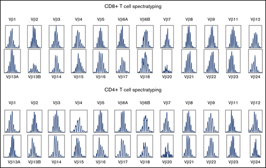 TCR spectratyping of CD8+ and CD4+ T cells during T-cell expansion in patient 3.