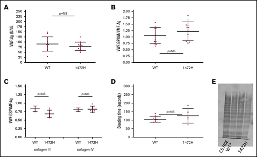 Comparison of wild-type and 1472H mice. (A) VWF expression was normal for both the WT* (human exon 28, human GPIbα replacing the murine sequence in those regions) and 1472H mice, as indicated by the similar levels of VWF:Ag between the groups. The y-axis denotes the VWF:Ag in U/dL for wild-type (WT*, D1472) and 1472H mice. Error bars denote 1 standard deviation. Squares represent male mice; circles represent female mice. (B) VWF binding to platelet GPIbα (VWF:GPIbM/VWF:Ag) also did not differ for 1472H mice. The y-axis denotes VWF:GPIbM/VWF:Ag ratios for the same groups of mice. (C) Collagen binding with type III (CB3) and type IV (CB4) collagen did not differ. The y-axis shows the collagen binding to VWF (VWF:CB/VWF:Ag) ratios for collagen III on the left and collagen IV on the right. Triangles represent mice for whom sex was not known. (D) Tail bleeding times in seconds for WT* and 1472H mice. No statistical difference was seen. (E) Multimer distribution for the WT* and 1472H mice. Lane 1 has a C57Bl6 plasma standard, lane 2 has WT* plasma, and lane 4 has the 1472H mouse plasma. Full multimer distribution was seen for all mice. (Lane 3 contains an irrelevant plasma.)