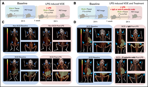 Experimental design and representative PET/CT scans. (A) SCD and non-SCD mice were imaged at baseline, and after 1 week they were injected intravenously with LPS and 64Cu-LLP2A. (B) In a separate set of experiments, mice were imaged at baseline, and after 1 week they were injected intravenously with LPS and either IgG isotype control or anti-P-selectin antibody plus 64Cu-LLP2A. (C) Representative PET/CT images of SCD and non-SCD mice 24 hours after injection of 64Cu-LLP2A at baseline and post-LPS challenge. There are distinct differences between VLA-4 expression in SCD and non-SCD mice post-LPS in the humeri and femurs (blue arrows). (D) Representative PET/CT images of SCD mice 24 hours after injection of 64Cu-LLP2A at baseline and post-LPS with IgG control treatment or anti-P-selectin antibody treatment. Anti-P-selectin treatment mitigates signal in the humeri and femurs (blue arrows) post-LPS.