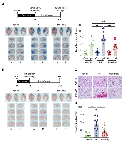 IFNβ alleviates delayed tPA–aggravated BBB disruption and HT in ischemic stroke. (A) Mice were subjected to 3-hour MCAO followed by IV administration of vehicle, tPA, or tPA plus IFNβ. Mice were then injected with Evans blue 1 hour before euthanization, and the ischemic brains were harvested at 6.5 hours postinjury followed by imaging and sectioning. The Evans blue leakage in the contralateral (Con) and ipsilateral (Ipsi) hemispheres was quantified (n = 10 per group). (B) Three-hour MCAO mice were administered with vehicle, tPA, or tPA plus IFNβ at 3 hours postinjury. The ischemic brains were harvested at 20 hours postinjury followed by sectioning and imaging. The representative brain section images are shown. (C) The representative hematoxylin and eosin staining images of 3 independent experiments are shown. Scale bar, 50 µm. (D) The levels of hemoglobin in the ipsilateral hemisphere of vehicle-, tPA-, and tPA plus IFNβ-treated MCAO mice were measured (n = 11 per group). *P < .05, ***P < .001 by 1-way ANOVA. A, anterior surface; P, posterior surface.