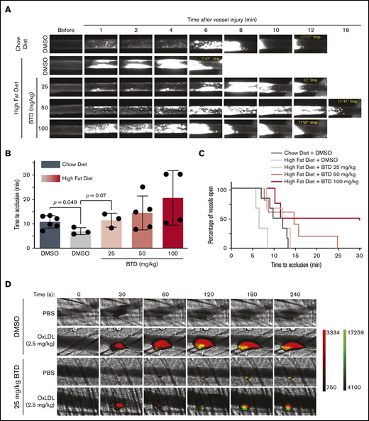 BTD carbon nucleophile decreases arterial thrombosis in dyslipidemia. BTD inhibits the prothrombotic platelet phenotype in “Western” high-fat diet-fed mice to chow-fed control levels using the FeCl3-induced carotid artery thrombosis model. (A) Intravital microscopy video images of the carotid artery from mice fed chow or a high-fat diet treated with vehicle control or 25 mg/kg BTD. (B-C) Histograms of time to occlusion (B), and Kaplan-Meier curves of the fraction of vessels not occluded (C) are shown (P = .01 between Chow Diet + DMSO vs High Fat Diet + DMSO; P = .46 between Chow Diet + DMSO vs High Fat Diet + 25 mg/kg BTD). BTD rescued the enhanced platelet and fibrin accumulation induced by oxLDL in the laser ablation cremasteric artery thrombosis model (C). (D) Intravital microscopy images of the cremasteric artery from intravenously injected PBS or 2.5 mg/kg oxLDL-injected mice treated with vehicle or 25 mg/kg BTD. Platelets are red and fibrin is green. (E,G) Median integrated fluorescence intensity over time of platelets (E) and fibrin (G) are shown. (F,H) Quantification of the normalized platelet (F) and fibrin (H) accumulation as area under the curve (AUC) by the length of the injury are presented. In both thrombosis models, DMSO (as the vehicle treatment) and BTD were prepared in 20% v/v cremophore in PBS and were injected intraperitoneally 3 hours before injury. P values were determined by unpaired Student t test (B), log-rank (Mantel-Cox) Kaplan-Meier tests (C), and 1-way analysis of variance with Kruskal-Wallis pairwise comparisons (F,H). For the FeCl3 thrombosis model, N = 6 mice for vehicle control treatment in conditions of a chow diet. N = 3 mice for vehicle control treatment, 3 mice for 25 mg/kg BTD treatment, 5 mice for 50 mg/kg BTD treatment, and 4 mice for 100 mg/kg BTD treatment in conditions of a high-fat diet. For the laser ablation thrombosis model, N = 3 mice for DMSO and 3 mice for BTD treatment and ≥22 injuries per PBS or oxLDL cohort of thrombosis. Data are expressed as mean ± SD.