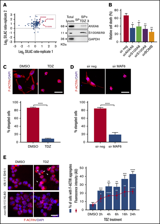 TDZ induces cytoskeletal rearrangement. (A) Scatterplot of the common SHI-1 proteins identified in 2 independent experiments of quantitative proteomics combined with affinity enrichment. Each data point is a single protein; proteins with log2 SILAC ratio >0 (box) denote the 88 inferred targets identified with buffer 1, whereas the 3 proteins represented by red triangles are those confirmed by buffer 2 (n = 2). Immunoblot analysis for SILAC validation. SHI-1 total proteins. Proteins eluted in the SP without TDZ3 (SP) and with TDZ3 (SP+TDZ3) were analyzed by western blot. (B) Cell death (annexin V+, PI+, and annexin V+/PI+) induced after 24 hours of treatment with TDZ 10 µM treatment in SHI-1 cell lines after ANXA6, S100A8, and S100A9 silencing (sir), used alone or combined (sirBOMB). (C-D) Representative confocal immunofluorescence images of SHI-1 cells seeded onto fibronectin-coated slides 4 hours after TDZ treatment (C), or 60 hours after silencing (sir) of MLL-AF6 fusion gene (D), stained with F-actin antibody (red) and diamidino-2-phenylindole (DAPI; blue) as the nuclear counterstain. Histograms represent the percentage of elongated cells (panel C; n = 46-146 cells and n = 114-225 cells). Original magnification ×63. Bars represent 10 μm. (E) Immunofluorescence of centrifuged SHI-1 and HL60 cells 4 hours after TDZ treatment, stained with F-actin antibody (red) and with DAPI (blue) as the nuclear counterstain. Arrows indicate F-actin aggregates. Histogram represents the percentage of SHI-1 cells containing F-actin aggregates 2, 4, 6, 16, or 24 hours after TDZ treatment (n = 152-333 cells). Original magnification ×63. Bar represents 10 μm. Data are the mean ± SEM. *P < .05; **P < .01; ***P < .001; ****P < .0001. Original magnification ×40. Bar represents 10 μm. AU, arbitrary unit.