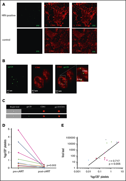 Antiretroviral therapy reduces viral uptake by platelets in persons with HIV. (A) Platelets were isolated from the plasma of viremic cART-naive individuals, RNAscope probing was done for the HIV gag gene (green), followed by immunostaining for CD61 as a platelet marker (red). Images were taken using a confocal microscope (60× objective). Results are representative of 2 donors. Platelets isolated from an HIV− individual were used as a negative staining control (lower panels). (B) Isolated platelets were immunostained for viral glycoprotein gp120, in addition to CD61, and imaged using super resolution microscopy. (C) Platelets were imaged using ImageStream flow cytometry and gated using CD61 and gp120. (D) The percentage of gp120+ platelets was determined prior to cART and 3 months following cART in 10 matching samples. Significance between groups was calculated using a Wilcoxon matched-pairs signed-rank test. (E) Correlation between viral load and percentage of gp120+ platelets was examined in samples with detectable viral loads. Correlation was calculated by nonparametric Spearman correlation.