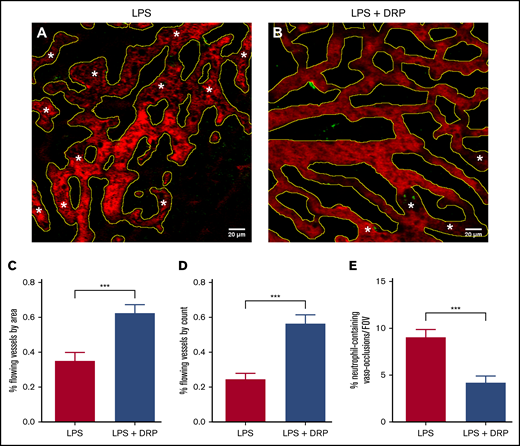 DRP reduces incidence of vaso-occlusion in the liver of transgenic SCD mice. (A-B) Still images obtained using qLIM techniques. Texas Red–dextran and Ly6G green were used to stain the blood plasma and neutrophils, respectively. RBCs can be discerned as dark shapes within the vessels and were not stained. Microscopy was performed using a Nikon MPE multiphoton excitation microscope in collaboration with the Center for Biologic Imaging (CBI), University of Pittsburgh. Yellow outlines denote areas identified as vessels. *Regions of vaso-occlusion where loss of blood flow was detected. Scale bars represent 20 µm. Three SCD mice treated with LPS (39 FOVs) and 3 SCD mice treated with both LPS and DRPs (30 FOVs) were used in this study. Blood flow in ∼30 blood vessels was assessed in each FOV. Quantification of the percentage of total flowing vessel area per FOV (C), and quantification of the percentage of total flowing vessels per FOV (D) by their individual count. (E) Number of neutrophil-containing vaso-occlusions per FOV in SCD mice. Data presented as mean ± standard error; ***P < .001.