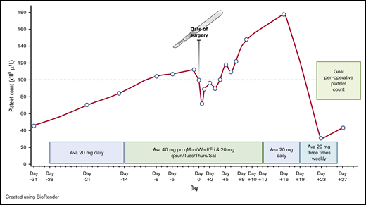 Avatrombopag-stimulated platelet count prior to and after neurosurgical procedure. Ava, avatrombopag; po, by mouth; qMon/Wed/Fri, every Monday, Wednesday, and Friday; qSun/Tues/Thurs/Sat, every Sunday, Tuesday, Thursday, and Saturday.