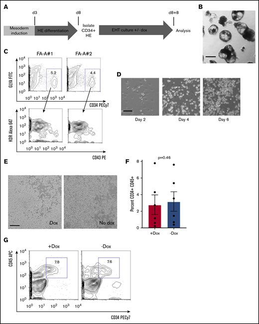 Hematopoietic differentiation of doxycycline inducible human FANCA patient IPSCs. (A) Schema for the differentiation of human IPSCs to HPCs adapted from published protocols.23,27 The first 8-day period involves morphogen-directed specification of hemogenic endothelium within EBs (see "Methods"). This period of culture incorporates 2 phases: BMP-4 and bFGF-mediated mesoderm induction, followed by HE differentiation driven by vascular endothelial growth factor, IL-11, insulin-like growth factor 1, and hematopoietic cytokines. At day 8, EBs were dissociated, and HE was isolated based on CD34+ selection. HE was plated on a 2-dimensional Matrigel substratum for an 8-day EHT culture in the presence of hematopoietic cytokines with or without doxycycline to modulate FANCA expression. At the end of the 8-day EHT culture, round floating HPCs were harvested for analysis in assays of clonogenicity and hematopoietic differentiation. (B) Representative image of day 8 EBs before dissociation (scale bar, 200 μm). (C) The entire cellular composition of dissociated day 8 EBs derived from the indicated human IPSC lines was stained with the indicated antibodies and definitive HE (CD34+GLYA−KDR+CD43−) was analyzed by flow cytometry gated on viable singlet cells. (D) Representative images of cultured HE at the indicated time points during EHT culture (scale bar, 50 μm). (E) Representative images of day 8 EHT culture in the presence or absence of doxycycline (scale bar, 100 μm). (F-G) Nonadherent, round cells were harvested at day 8 EHT and analyzed for expression of the indicated surface markers of HPCs by flow cytometry. Percent CD34+CD45+ HPCs within the nonadherent population was quantified over 6 independent experiments (results presented as mean ± SEM, analyzed by a paired Student t test).
