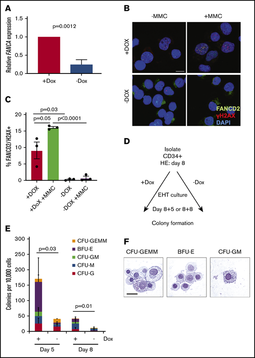 Analysis of FANCA-deficient and FANCA-expressing IPSC-derived hematopoietic cells. (A) Total RNA was isolated from the nonadherent cells at day 8 EHT, and expression of FANCA was analyzed by quantitative PCR (n = 3 biologic replicates; results presented as mean ± SEM, analyzed by a Student t test). (B-C) Nonadherent cells were isolated at day 8 of EHT after culture with or without doxycycline and then cultured with mitomycin C (20 ng/mL) for 18 hours, at which time the cells were fixed and immunostained for FANCD2 and γH2AX and visualized by confocal microscopy (scale bar, 10 μm). Results are compiled from 3 separate lines, and the proportion of cells with double-positive foci presented as mean ± SEM, analyzed by a paired Student t test. (D-E) A total of 10 000 nonadherent cells collected from day 5 or day 8 EHT cultures were embedded into methylcellulose with hematopoietic growth factors. Doxycycline was either maintained in these assays or withheld consistent with EHT culture conditions. After 14 days, colonies were scored morphologically, and the results were quantified (n = 7 biologic replicates for day 5 and n = 10 biologic replicates day 8 across 3 cell lines; total colony numbers analyzed by a paired Student t test, results are presented as mean proportions of each colony type ± standard deviation). (F) Hematopoietic colonies were isolated at day 14 from cultures with doxycycline and spun onto slides when the cells were stained with May-Grünwald-Giemsa and analyzed by light microscopy (scale bar, 10 μm).