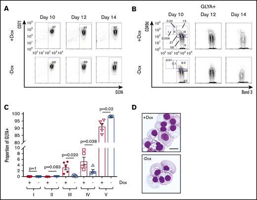 Erythroid differentiation of FANCA-expressing or -deficient IPSC-derived hematopoietic cells. (A) Day 8 nonadherent cells from EHT culture were cultured in a cytokine cocktail containing erythropoietin for the indicated periods of time after the initiation of EHT culture, when erythroid differentiation was measured by flow cytometry for CD71 and GLYA expression. (B) Within the GLYA+ gate, cell surface expression of CD49d and Band 3 was measured by flow cytometry. Stages of erythroid differentiation were quantified by gating as described previously.42 (C) Stages of erythroid differentiation were quantified at day 14, and each stage was compared by a Student t test (n = 5 biologic replicates, results presented as mean ± SEM). (D) Representative morphology of day 14 erythroid differentiation culture (scale bar, 10 μm).