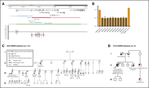 Large heterozygous PARN deletions can be tolerated without neuropsychiatric disorders but may feature cytopenias. (A) Schematic of the genomic region surrounding the deletion and location and distribution of the microarray probes. The genomic region displayed here ranges from 14.4 to 14.9 Mb on the short arm of chromosome 16. All 6 protein-coding genes and their distribution of exons are shown in the upper part of the schematic. The middle part includes the deletions of proband 832 III.1 and proband 1210 II.1 found in our study (red bars) determined by microarray and/or quantitative real-time PCR. The distal breakpoint of the deletion ex1-21 is located upstream of PARN within the dashed bar between exon 4 of PLA2G10 and exon 13 of NOMO1. The blue bars indicate the previously described 4 intragenic deletions of PARN in the study from Dhanraj et al45 with the proximal breakpoint in patient 4 located further downstream (dashed bar). The green bar represents the previously reported whole-gene deletion in the study from Moon et al46 with both the proximal and distal breakpoints located outside of the gene schematic (dashed bar). The bottom part displays the distribution and location of the microarray probes used for proband 832 III.1. The mean log2 ratio of the deleted probes is −0.65, and the deleted region is highlighted with a red bar. (B) Mapping of the distal breakpoint. Quantitative real-time PCR results of the relative copy number of exon 17 of PARN, exon 1-8 of BFAR, exon 4 of PLA2G10, and exon 13 of NOMO1 compared with the non-deleted exon 22 of PARN. Values at or around 0.5 indicate a heterozygous loss, and values at or around 1 indicate the presence of both alleles. (C-D) Pedigrees of a large family with a heterozygous deletion of exons 1-21 of the PARN gene and a family with a single exon PARN deletion. A circle represents a woman, and a square represents a man. Roman numerals indicate generations (eg, I, II, III, IV). A slash through the circle or square indicates that the person is deceased. The proband is indicated by the arrow. The variant carrier status is mut/+ for carriers and +/+ for wild type. OC indicates an individual who is an obligate carrier of the familial PARN deletion. The phenotype is detailed below the symbol. The pedigree number and variant found in each family are noted above the pedigree.