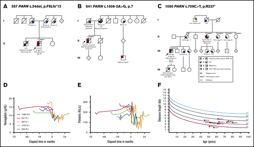 Hematologic abnormalities and telomere lengths in carriers of heterozygous variants in PARN. (A-C) Pedigrees of families with segregating PARN variants. A circle represents a woman, and a square represents a man. Roman numerals indicate generations (I, II, III, IV). A slash through the circle or square indicates the person is deceased. The proband is indicated by the arrow. The variant carrier status is mut/+ for carriers and +/+ for wild type. OC indicates an individual who is an obligate carrier of the familial PARN variant. Color-shaded quarters represent different phenotypes differentiated by color: red stands for cytopenia, AA, or BMF; purple stands for ILD; blue indicates the diagnosis of a malignancy; and green marks all other TBD-associated symptoms. The exact disease/phenotype is detailed below the symbol. Pedigree numbers and the variant found in each family are all designated above the pedigree. Longitudinal hemoglobin (D) and platelet count (E) in patients pre– and post–lung transplantation. Spaghetti plots depict longitudinal blood counts from 3 PARN variant carriers (purple, red, orange) and 2 TERT variant carriers (green, blue) pre– and post–lung transplantation. The time of double-lung transplant is indicated as time point 0, and negative and positive values on the x-axis indicate the number of months before or after transplantation. (F) Peripheral blood lymphocyte telomere lengths as measured by flowFISH. Telomere length from each individual variant carrier is displayed as a red dot with his or her respective pedigree and individual ID number. Each individual’s age-adjusted telomere length is plotted compared with the testing laboratory’s population of healthy age-adjusted control subjects (in percentiles). HSCT, hematopoietic stem cell transplantation.