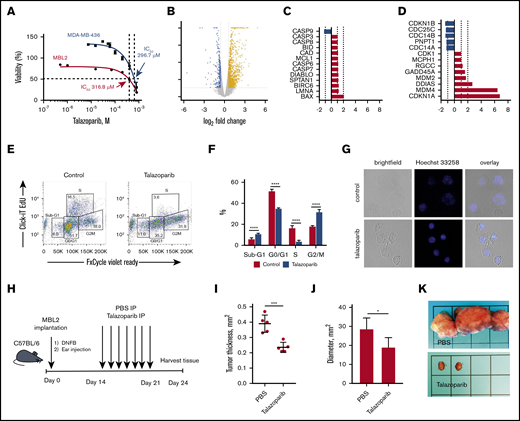 Talazoparib arrests the cell cycle of lymphoma cells at G2/M. (A) Dose-response cell-viability curves at 24 hours for MBL2 and MDA-MB-436. (B) A volcano plot showing changes in transcriptome associated with the effect of talazoparib at IC25 on the survival properties of MBL2 cells identified by RNA sequencing. (C) The transcriptional changes in the apoptosis pathway in MBL2 cells treated with IC25 of talazoparib. (D) The transcriptional changes in the cell cycle pathway in MBL2 cells treated with IC25 of talazoparib. (E) Cell cycle assessment after treatment of MBL2 cells with IC25 of talazoparib. Click-iT EdU with FxCycle Violet Ready Assay. Representative flow cytometry. (F) The differences between the phases of cell cycle of cells treated with IC25 of talazoparib and controls. ****P < .0001. (G) Hoechst 33258 fluorescent staining to show DNA breakage in MBL2 after exposure to talazoparib. Representative images, confocal macroscopy (original magnification, ×100). (H) An outline of the murine experiment. (I) The measurement of the thickness of the orthotopic tumors 21 days after treatment with talazoparib; n = 5 mice per group. ***P < .001 (J) The measurement of the diameter of the regional lymph nodes 21 days after treatment with talazoparib; n = 5 mice per group. *P < .05 (K) Representative images of regional lymph nodes treated with PBS or talazoparib.