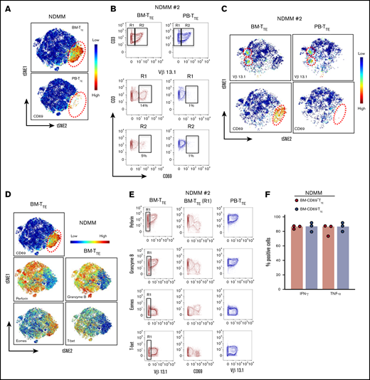 Detailed phenotype of CD69−TTEand CD69+TTEcells in NDMM patients. (A-E) Mass cytometry data. (F) Fluorescence flow cytometry data. (B-C,E) Data from 1 representative NDMM patient (NDMM #2; Figure 3B,G). (A) tSNE plots show distribution of CD69−TTE and CD69+TTE cells within pooled BM-TTE and PB-TTE cells of NDMM patients (n = 5). The area occupied by CD69+TTE cells is indicated by the red dotted circle. (B) Biaxial contour plots show BM-TTE and PB-TTE cells containing oligoclonal expanded Vβ13.1 family–expressing cells of NDMM patient #2. Regions indicate Vβ13.1−TTE cells (R1) and Vβ13.1+TTE cells (R2, top panel). Biaxial contour plots gated for Vβ13.1−TTE cells (R1, middle panels) and Vβ13.1+TTE cells (R2, bottom panels) show presence of CD69+TTE cells indicated by boxes and numbers. (C) tSNE plots show distribution of Vβ13.1 family–expressing TTE cells (top) and CD69+TTE cells (bottom) within BM-TTE and PB-TTE cells of NDMM #2 indicated by red dotted circles. (D) tSNE plots show distribution of CD69, perforin, granzyme B, Eomes, and T-bet within pooled BM-TTE cells of NDMM patients (n = 5). (E) Biaxial contour plots showing expression of perforin, granzyme B, Eomes, and T-bet in oligoclonal expanded Vβ13.1 family–expressing cells and remaining TTE cells in BM and PB of NDMM patient #2. Gated BM-TTE cells that do not express Vβ13.1 family (R1) are shown in the middle panels. (F) Bars (median with scatter plots) show proportion of BM-CD69+TTE and BM-CD69−TTE cells producing IFN-γ and TNF-α (NDMM, n = 3).