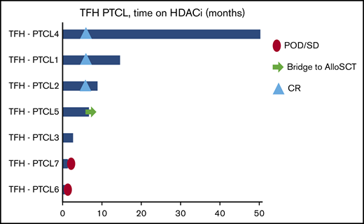 Swimmer’s plot detail of the patients with TFH PTCL. POD, progression of disease.