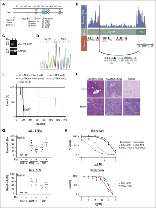 Identification of a novel MLL-TFE3 in infant leukemia patient. (A) The reported fusion partners of TFE3-rearrangements in renal cell carcinoma and alveolar soft part sarcoma. The figure is modified from St Jude PeCan protein viewer (https://pecan.stjude.cloud/proteinpaint/).19 The breakpoint is shown relative to the TFE3 domains and the location of the amino acid, with the number of reported cases in the St Jude database shown in circles. (B) RNA-seq analysis using JAFFA20 identified a novel MLL-TFE3. Image shown is modified from a fusion visualization tool, Clinker.21 RNA read coverage is shown as reads per million (RPM), across the genes involved in the rearrangement. Protein domains involved in the fusion arrangement are also shown. (C) RT-PCR of the patient with MLL-TFE3 (1) and a leukemia patient with different rearrangement (2) using a primer set flanking the predicted breakpoint sequence of MLL-TFE3 (MLL-TFE3 BP) and GAPDH as an internal control for RT-PCR. (D) Sanger sequencing of patient cDNA showing the breakpoint sequence of MLL-TFE3. (E) Kaplan-Meier curves of the syngeneic mouse model. MLL-r with the NRasG12D cooperating mutation (solid lines), MLL-AF9 (blue line; n = 4), and MLL-TFE3 (red line; n = 5) are shown. MLL-r without the NRasG12D cooperating mutation (dashed lines), MLL-AF9 (blue dashes; n = 2), and MLL-TFE3 (red dashes; n = 3) are shown. Mice expressing only the NRasG12D mutation were included as control (brown line; n = 4). P value between MLL-AF9 and MLL-TFE3 mice, both in the presence of the NRasG12D mutation, is shown. A tick on the line indicates nonleukemic deaths, while the asterisk indicates the end of experimental cohort. (F) Representative hematoxylin and eosin staining of liver and spleen (original magnification ×10; scale bars, 200 µm) of MLL-AF9+NRasG12D, MLL-TFE3+NRasG12D, and normal mice. Blasts can be seen in the spleen and liver of MLL-AF9 and MLL-TFE mice, but not in the normal control. (G) Summary of the immunophenotyping result of the ex vivo bone marrow cells in the absence (−) or the presence (+) of doxycycline (Dox), analyzing the expression of myeloid markers. The data are plotted as scatter dot plot with mean value. (H) Summary of drug assay treatments using birinapant (±emricasan) (n = 5) and venetoclax (n = 5). The data are shown as percent viability of cells (by 4′,6-diamidino-2-phenylindole exclusion), normalized to untreated cells, and plotted against log concentration of drugs tested, with nonlinear regression analysis (variable slope). AT, AT hooks; bHLH, basic Helix-loop-Helix domain; bromo, bromodomain; CxxC, cysteine-rich region; D.P., double-positive stained cells; EFS, event-free survival; FYRC, FY-rich domain (C-terminal); FYRN, FY-rich domain (N terminal); LMI, LEDGF and menin interaction domain; LZip, leucine zipper; PHD, plant homeodomain; Pro, proline-rich domain; SET, Su(var)3-9, enhancer-of-zeste and trithorax domain; SNL, speckled nuclear localization signals.