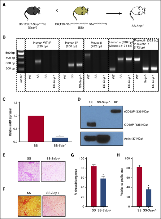 Generation and characterization of SS-Selp−/−mice. (A) Selp−/− mice were bred to Townes SS mice to generate SS-Selp−/− mice. Refer to supplemental Figure 1 for the breeding strategy. (B) Genomic PCR gel image showing the presence or absence of different alleles in C57BL/6 (WT) mice, Townes AS (AS) mice, Townes SS (SS) mice, Selp−/− mice, and SS-Selp−/− mice. Human WT β-globin (WT βA), mouse β-globin, mouse α-globin, and mouse WT P-selectin alleles were absent in SS-Selp−/− mice, but human βS, human α-globin, and mouse mutant P-selectin (P-selectin−/−) alleles were present in SS-Selp−/− mice. (C) RT2qPCR analysis revealed a significant reduction in the mRNA levels of P-selectin in the aortas of SS-Selp−/− mice compared with SS mice. Data are mean relative mRNA expression ± standard deviation (SD). (D) Western blot analysis of CD62P protein levels in platelets isolated from SS and SS-Selp−/− mice. P-selectin (135 kDa) was expressed in platelets of SS mice but was absent in platelets of SS-Selp−/− mice. Actin (37 kDa) was used as a loading control. Recombinant mouse P-selectin–Fc fusion protein (RP; 235 kDa; R&D Systems) was used as a positive control. Data in panels C-D are representative of 3 female SS mice and 3 female SS-Selp−/− mice. Representative IHC images showing sinusoidal congestion by H&E staining (E) and fibrosis and collagen deposition by Sirius Red staining (F) in the liver sections of SS and SS-Selp−/− mice. Original magnification ×40. (G) Percentage of sinusoidal congestion based on H&E staining. (H) Quantification of liver fibrosis as the percentage of the area positive for Sirius Red staining. Data in panels G-H are mean ± SE based on 3 male SS mice and 3 male SS-Selp−/− mice. *P < .05.