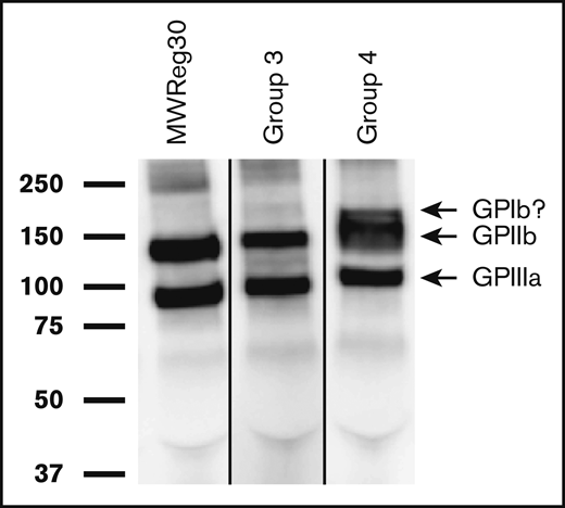 Alloantibodies recognize GPIIb/IIIa on platelets from the strain used for immunization. Biotin-labeled platelet membrane proteins from the mouse strain used for immunization were immunoprecipitated with alloantibodies from immunized mice, subjected to SDS–polyacrylamide gel electrophoresis and detected by western blotting with horseradish peroxidase–streptavidin as described in “Methods.” Molecular weight standards are indicated on the left. Shown here are representative results obtained in 2 of 12 studies involving immunization of SPRET (group 3) and PWK (group 4) mice with C57 platelets. Bands identified correlate with those precipitated by monoclonal rat anti-mouse antibody MWReg30 specific for mouse GPIIb/IIIa (left gel). The extra band above the GPIIb band obtained with alloantibody from group 4 has the apparent molecular weight expected for GPIb (170 kDa) but was not further investigated. The lanes were run on the same gel but were noncontiguous.