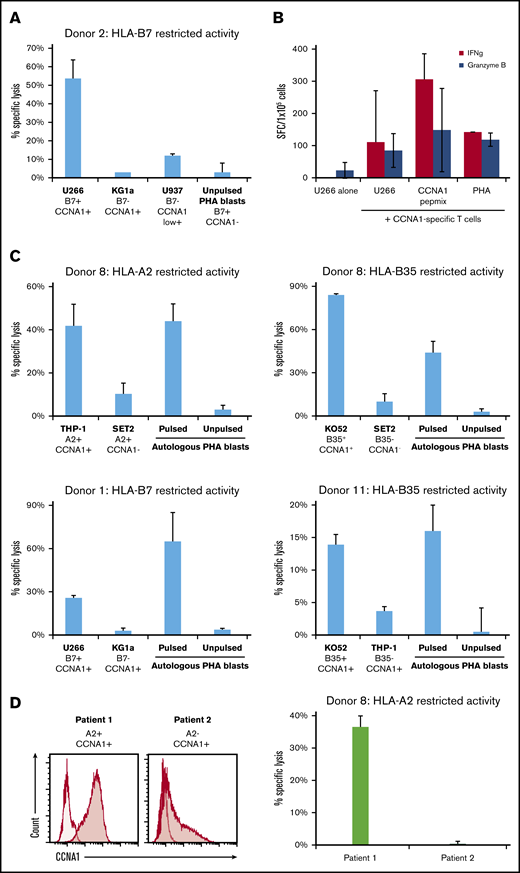 CCNA1-specific T cells show cytotoxicity against HLA-matched, CCNA1+tumor cell lines. (A) Donor 2’s cell line showed high specific lysis toward U266 (HLA-B7+ and CCNA1+) in a 4-hour Cr51-release assay, compared with targets that express either HLA-B7 or CCNA1 alone. (B) Similarly, donor 2’s cell line produced IFN-γ and granzyme B, as assessed by ELISpot, following incubation with the U266 cell line, but not when U266 was cultured alone. (C) Further examples of CCNA1-specifc T cells from donors with characterized HLA-restricted CCNA1 reactivity, showing specific lysis toward CCNA1-expressing leukemic cell lines matched at the relevant HLA allele, with minimal activity against targets that were HLA mismatched and/or CCNA1 negative. (D) CCNA1 expression of 2 primary AML cell lines (left; CCNA1, shaded curve; no primary control, unshaded curve) with HLA-A2 status of patients, and specific lysis of patient 1’s AML blasts (right).