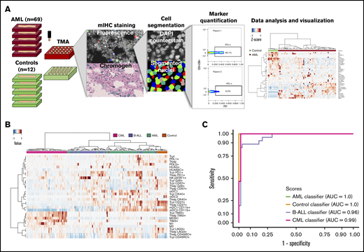 Immunocharacterization of the AML, B-ALL, CML, and control BM. (A) Visualization of the quantitative BM immunocharacterization pipeline. FFPE BM tissue blocks of AML patients (n = 69) and age- and sex-matched controls (n = 12) were retrieved from the Helsinki Biobank. TMAs were constructed from duplicate punches (1 mm in diameter) from each subject. TMAs were cut onto tissue slides and stained with mIHC consisting of ≤4 primary antibodies detected with fluorescence dyes and 4′,6-diamidino-2-phenylindole (DAPI) counterstain as well as 2 primary antibodies detected with chromogenic probes and hematoxylin counterstain. Tissue slides were scanned after both staining procedure and corresponding images registered to ensure that the location of individual cells is matched in parallel stainings. Following cell segmentation, marker colocalization and intensity were quantified in identified cells. (B) Immune cells (as a proportion of all cells in a TMA spot) and their immunophenotypes (as a proportion of their parent immune cell) derived from mIHC and computerized image analysis are plotted on a heatmap and organized by hierarchical clustering using Spearman correlation distance and the Ward linkage (ward.D2) method. Immunologic parameters are arranged in rows and patients in columns. Red denotes higher and blue lower proportions. (C) Using 10-fold crossvalidated elastic net–regularized logistic regression analysis, 4 subtype-specific classifiers were developed to identify AML, B-ALL, and CML patients and controls. Classifiers were developed with a training group (n = 94) and assessed with a test group (n = 95). The accuracy of the classifiers was evaluated on the test group with receiver-operator curves (AUC).