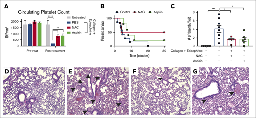 NAC reduces pulmonary thrombus formation in vivo. (A) Platelet counts in adult mice 1 hour before and 5 minutes following IV injection with a mixture of collagen (0.8 mg/kg) + epinephrine (6 mg/kg). (B) Kaplan-Meyer curve representing survival of mice injected with collagen + epinephrine mixture to induce a thromboembolism. Survival was recorded as 30 minutes after injection. (C) Quantification of pulmonary thrombi per image field. (D-G) Representative histology images of lungs from untreated control (D), collagen/epinephrine-treated (E), NAC + collagen/epinephrine (F), or aspirin + collagen/epinephrine (G). Pulmonary thrombi are indicated by black arrowheads; n = 6 mice per group, original magnification ×20. *P < .05, **P < .01, ***P < .001, and ****P < .0001, 2-way ANOVA. Error bars represent SEM. Shown are representative data from 3 biological replicates.