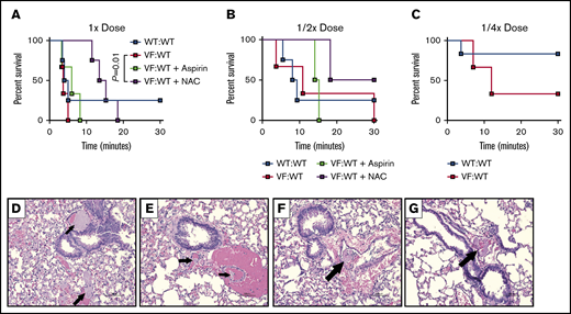 NAC improves survival following induction of acute thrombosis in mice transplanted with JAK2V617Fcells. Control (WT:WT) and JAK2V617F engrafted (VF:WT) mice were pretreated with aspirin (50 mg/kg) or NAC (400 mg/kg) for 1 hour, and then treated with decreasing concentrations of a mixture of collagen and epinephrine via retro-orbital injection. (A-C) Kaplan-Meyer curve representing survival of mice injected with collagen and epinephrine concentrations of 0.8 mg/kg and 6 mg/kg (A), 0.4 mg/kg and 3 mg/kg (B), and 0.2 mg/kg and 1.5 mg/kg (C), respectively. (D-G) Representative hematoxylin and eosin–stained lung tissues from collagen and epinephrine-injected mice. Treatments include control (WT:WT) (A), VF:WT (B), VF:WT + NAC (C), and VF:WT + aspirin (D). Arrows represent thrombi. P = .01, log-rank test. n = 3-4 mice per group, original magnification ×20. Shown are representative data from 2 biological replicates.