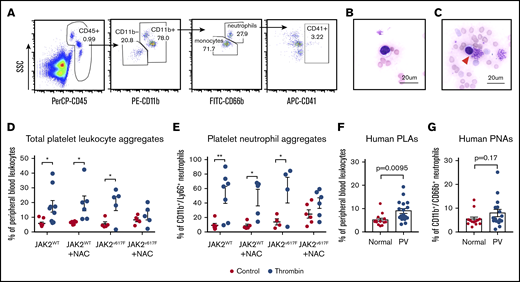 NAC inhibits thrombin-induced PLA formation in JAK2V617Fknockin mice. (A) Representative gating strategy to measure circulating or thrombin-stimulated PLAs (based on CD45+/CD41+ double-positive events). PNAs are defined as CD45+/CD11b+/CD66b+ (for human) or Ly6G+ (for mice)/CD41+ events. (B) Bright-field image of unstimulated murine blood smear stained with Wright Giemsa. (C) Bright-field image of PLA (denoted by red arrowhead) from murine blood stimulated with 2 U thrombin. Original magnification ×60; scale bars represent 20 μm. (D-E) Quantification of PLAs (D) or PNAs (E) in WT or JAK2V617F knockin mice with or without NAC treatment. *P < .05, **P < .01, 2-way ANOVA. (F-G) Circulating PLAs (F) or PNAs (G) in fresh human blood from patients with PV and healthy donors. Each data point represents an individual. Error bars represent SEM. Shown are representative data from 3 biological replicates. SSC, side scatter.
