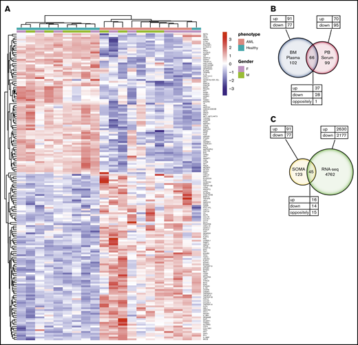 Differential protein expression in the BM of patients with AML compared with healthy control subjects. (A) A heatmap representation of a total of 168 differentially expressed analytes measured by SOMAscan assay using the BM plasma samples obtained from patients with AML (n = 10) and healthy control subjects (n = 10). Heatmap rows and columns were hierarchically clustered (unsupervised) within the groups. Color scale indicates relative expression, with more abundant proteins shown in red and less abundant proteins shown in blue. (B) A Venn diagram of unique and shared proteins identified as dysregulated by SOMAscan analysis of the BM plasma and PB serum samples obtained from patients with AML and healthy control subjects. Comparison of SOMAscan proteomic signatures of patients with AML vs healthy control subjects revealed 65 analytes similarly regulated and 1 analyte differently regulated in BM plasma and PB serum samples. (C) A Venn diagram illustrating the unique and overlapping differential expression events between the proteomics data obtained from SOMAscan analysis of BM plasma samples and the transcriptome data generated by in-depth bulk RNA-sequencing of whole BM aspirate cells.
