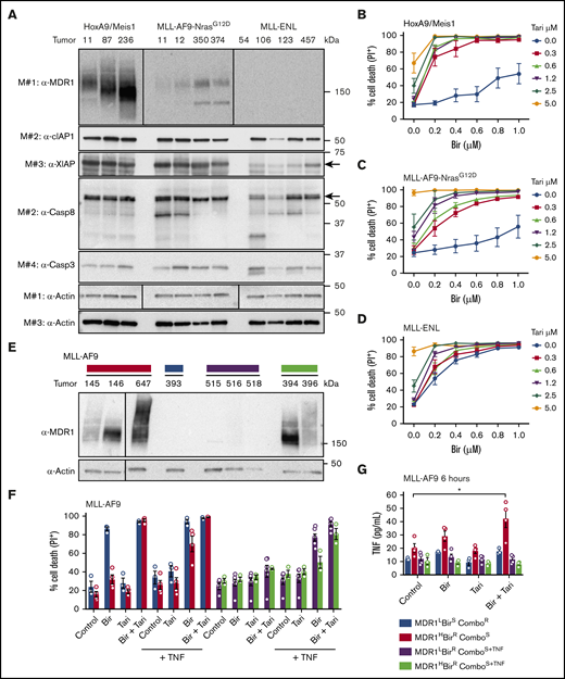 MDR1 and TNF are biomarkers of birinapant response in murine AMLs. (A) Whole-cell lysates from HoxA9/Meis1, MLL-AF9-NrasG12D, and MLL-ENL AML cells were probed with the indicated antibodies, with actin used as the loading control. M# indicates the different membranes. Tumor numbers indicate leukemias originating from individual mice. HoxA9/Meis1 (n = 5; tumors 87, 236, and 11) (B); MLL-AF9-NrasG12D (n = 4; tumors 11, 12, 350, and 374) (C); and MLL-ENL (n = 4; tumors 457, 126, 106, and 123) (D). AML cells were treated with Tari (0.3, 0.6, 1.2, 2.5, and 5 μM), with or without Bir, for 24 hours. (E) Western blot analysis of MDR1 in independent MLL-AF9 AML cells. (F) MDR1L, birinapant-sensitive (BirS), combination-resistant (ComboR) (blue bars, n = 3; tumor 393); MDR1H, birinapant-resistant (BirR), combination-sensitive (ComboS) (red bars, n = 4; tumors 145 and 647); MDR1L, BirR, ComboS+TNF (purple bars, n = 6; tumors 515, 516, and 518); and MDR1H, BirR, and ComboS+TNF (green bars, n = 3; tumors 394 and 396) AML cells were treated for 24 hours with Bir (500 nM), with or without Tari (500 nM) and with or without TNF (100 ng/mL). (G) TNF production in 4 MLL-AF9 AML subgroups was determined by ELISA. Cells were treated with Bir (500 nM), with or without Tari (500 nM), for 6 hours (1-2 individual tumors for each subgroup; 2-3 repeats). Data are the mean ± SEM throughout. Cell death was measured by flow cytometry analysis of PI uptake and decrease in cell volume. P values were obtained by comparison of control and Bir/Tari treatment. *P < .05.