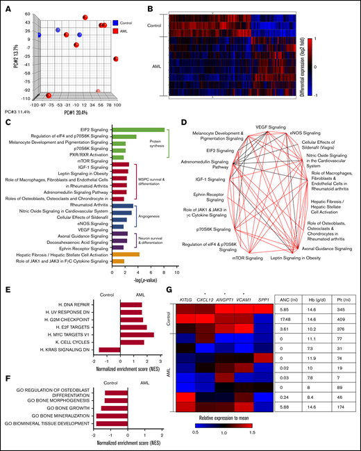 Bone marrow MSPCs from AML patients harbor a distinct gene expression profile. (A) Principal component (PC) analysis of MSPCs isolated from AML patients and non-leukemic donors. (B) Hierarchical cluster analysis of genes with significantly different expression between MSPCs from AML patients (n = 8) and controls (n = 3) by the unweighted pair-group method with arithmetic averages. Gene signal intensities were normalized to the mean signal of all samples with log10 transformation. Horizontal rows represent individual samples; vertical columns represent individual genes. Black indicates average signal intensity, brightest red represents twofold or higher upregulated, and brightest blue represents twofold or lower downregulated gene expression relative to the mean. (C) Twenty top altered canonical pathways (P < .05) in bone marrow MSPCs from AML patients compared with controls were generated by Ingenuity Pathway Analysis (IPA) software (QIAGEN) and subcategorized into 4 functional groups. (D) Overlapping canonical pathway analysis generated by IPA. Black line indicates 4 genes and red line indicates more than 4 genes were shared between connected pathways. (E) Gene set enrichment analysis (GSEA) of proliferation-related gene sets with normalized enrichment score (NES) >1.5 and P < .05. (F) GSEA of osteogenesis-related gene sets with NES >1.5 and P < .05. (G) Left: heatmap of HSC-regulating genes in MSPCs from AML patients and controls. Gene signal intensities were central to the mean signal of individual gene symbols. Horizontal rows represent individual samples; vertical columns represent individual genes. Black indicates average signal intensity, brightest red represents 1.5-fold or higher upregulated, and brightest blue represents twofold or higher downregulated gene expression relative to the mean. Right: complete blood count of peripheral blood from corresponding patients at diagnosis including hemoglobin (Hb), absolute neutrophil count (ANC), and platelet (Plt). *P < .05 (determined by unpaired Student t test).