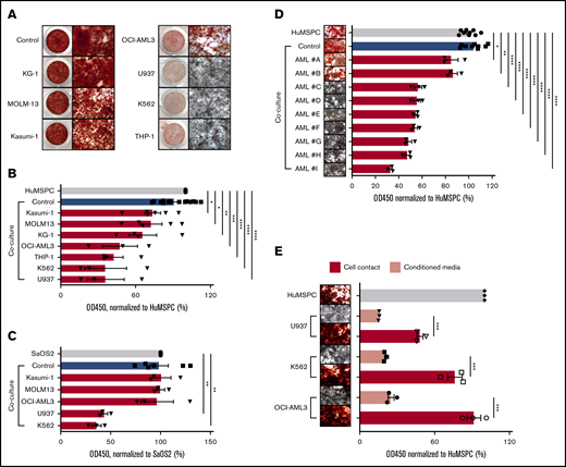 AML infiltration inhibits osteogenesis. (A) Alizarin red staining to detect calcium deposition after 14 days of induction of mineralization in HuMSPCs in the presence of PBMNCs from healthy donors (control) or different AML cell lines. Left: low-magnification image of a 48-well plate; right: images (4× objective) showing calcium deposition. (B) Colorimetric detection of alizarin red staining using absorbance at 450 nm to quantify calcium deposition in HuMSPCs after 14 days of induction of mineralization in the presence of healthy PBMNCs as controls or different AML cell lines (representative of 9 independent experiments). (C) Colorimetric detection of alizarin red staining using absorbance at 450 nm to quantify calcium deposition in SaOS2 cells after 7 days of induction of mineralization in the presence of controls or different AML cell lines (representative of 6 independent experiments). (D) Images (4× objective) of 96-well plate and colorimetric detection of alizarin red staining using absorbance at 450 nm to quantify calcium deposition in HuMSPCs after 14 days of induction of mineralization in the presence of controls or primary AML cells (3 replicates per sample). (E) Image (4× objective) and colorimetric detection of alizarin red staining using absorbance at 450 nm to quantify calcium deposition in HuMSPCs after 21 days of induction of mineralization in the presence of different AML cell lines or corresponding conditioned medium (representative of 3 independent experiments). Data are shown as mean ± SEM. *P < .05; **P < .01; ***P < .001; ****P < .0001 (determined by unpaired Student t test).