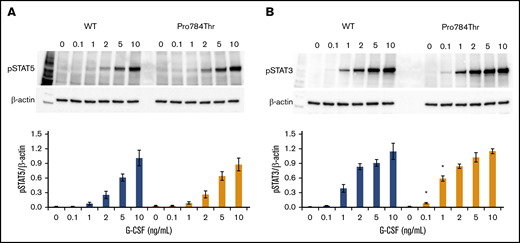 G-CSF hypersensitivity of the p.Pro784Thr CSF3R variant correlates with STAT3 phosphorylation responses. Cells expressing p.Pro784Thr CSF3R or WT CSF3R were serum and cytokine deprived for 2 hours and then stimulated with the indicated concentrations of G-CSF for 30 minutes. (A-B) Whole-cell lysates were immunoblotted with antibodies to phosphorylated STAT5 (pSTAT5), pSTAT3, and β-actin. Representative blots of 3 independent experiments are shown. Densitometric analyses of the immunoblots were performed using ImageJ software. The data are presented as the ratios of pSTAT/β-actin. Error bars show the standard error. *P < .05.