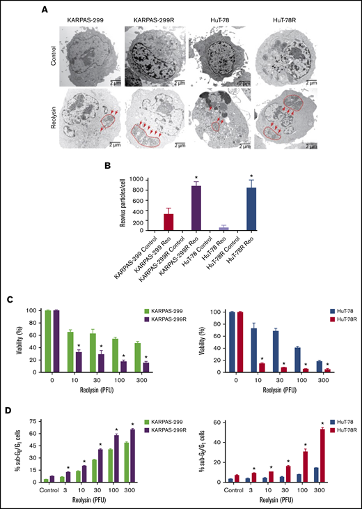 Belinostat-resistant TCL cells are hypersensitive to oncolytic reovirus replication and Reolysin-mediated cell death. (A) Reovirus viral load is significantly greater in belinostat-resistant TCL cells. Karpas-299 and HuT-78 cells were treated for 48 hours with 45 and 90 PFUs of Reolysin per cell, respectively. Reovirus accumulation was visualized by electron microscopy (arrows indicate reovirus accumulation). (B) Quantification of reovirus in parental and belinostat-resistant TCL cells. The number of reovirus particles per cell was quantified using ImageJ software. Data are shown as mean ± SD (n = 5). *P < .05 indicates a significant difference compared with parental cells treated with Reolysin. (C) Belinostat-resistant cells are hypersensitive to Reolysin-mediated cell death. Belinostat-resistant and parental cells were treated with the indicated amounts of Reolysin, and cell viability was determined by MTT assay after 72 hours of treatment. Data are shown as mean ± SD (n = 3). *P < .05 indicates a significant difference compared with parental cells treated with the same concentration of Reolysin. (D) Belinostat-resistant cells display increased sensitivity to Reolysin-mediated apoptosis. TCL cells were treated with Reolysin for 48 hours, and apoptosis was quantified by PI-FACS analysis in parental and belinostat-resistant Karpas-299 and HuT-78 cells. Data are shown as mean ± SD (n = 3). *P < .05 indicates a significant difference compared with parental cells.