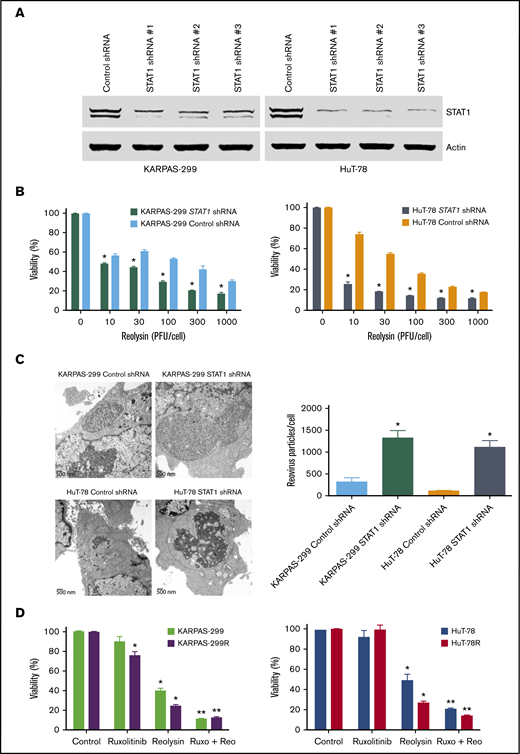 Targeting STAT1 enhances the antilymphoma activity of oncolytic reovirus. (A) Silencing STAT1 expression in TCL cell lines. STAT1 was knocked down in parental Karpas-299 and HuT-78 cells using 3 different lentiviral shRNA constructs, and efficiency was assessed by immunoblotting. STAT1 shRNA #1 was used for all experiments. (B) Reolysin exhibits greater antilymphoma activity in TCL cells with diminished STAT1 levels. TCL cells infected with Control and STAT1 shRNA were treated with the indicated concentrations of Reolysin for 72 hours, and cell viability was determined by MTT assay. Data are shown as mean ± SD (n = 3). *P < .05 indicates a significant difference compared with Control shRNA cells treated with the same concentration of Reolysin. (C) Reovirus viral load is significantly greater in TCL cells with STAT1 knockdown. Karpas-299 and HuT-78 cells were treated for 48 hours with 45 and 90 PFUs Reolysin per cell, respectively. Reovirus accumulation was visualized by electron microscopy. Circles indicate reovirus accumulation. Quantification of reovirus in Control and STAT1 shRNA TCL cells. The number of reovirus particles per cell was quantified using ImageJ software. Data are shown as mean ± SD (n = 5). *P < .05 indicates a significant difference compared with Control shRNA cells treated with Reolysin. (D) Treatment with the JAK inhibitor ruxolitinib sensitizes TCL cells to Reolysin treatment. Parental and belinostat-resistant Karpas-299 and HuT-78 cells were treated with 45 and 90 PFUs Reolysin per cell, respectively, 5 μM ruxolitinib, or the combination for 72 hours, and cell viability was measured by MTT assay. Data are shown as mean ± SD (n = 3). *P < .05 indicates a significant difference compared with Control or **P < .05 for treatment with either ruxolitinib or Reolysin as a single agent.