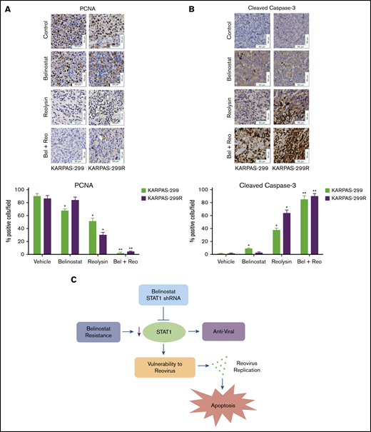 The combination of Reolysin and belinostat results in significantly decreased tumor cell proliferation and augmented apoptosis in parental and belinostat-resistant Karpas-299 tumors. (A-B) Immunohistochemical analysis demonstrates that administration of Reolysin and belinostat effectively decreases PCNA-positive cells (A) and induces significant levels of caspase-3–positive cells (B). Percent PCNA and active caspase-3–positive cells were determined by manual counting. Data are shown as mean ± SD (n = 3 random fields). *P < .05 indicates a significant difference from vehicle or **P < .05 for treatment with either belinostat or Reolysin as a single agent. Scale bars represent 50 μm. (C) Belinostat-induced reduction in STAT1 expression increases TCL cell vulnerability to oncolytic reovirus-mediated cell death. The development of belinostat resistance, acute treatment with belinostat, or STAT1 shRNA infection decreases the expression of STAT1. Oncolytic reovirus replicates significantly more effectively in belinostat-resistant cells and when administered in combination with belinostat resulting in enhanced antilymphoma activity.