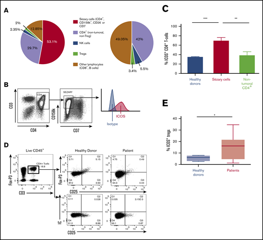 ICOS expression of malignant cells in the blood of patients with SS. (A) Percentages of lymphoid cell populations within peripheral blood of 13 patients with SS and 12 healthy donors using flow cytometry. NK, natural killer. (B) Gating strategy for Sézary cells (CD4+CD158k+CD7−) by flow cytometry for a representative patient. (C) Flow cytometric evaluation of ICOS expression in patients with SS and healthy donors. Percentage of ICOS+ cells among Sézary CD4+ T cells and nontumoral CD4+ T cells. Sézary cells were defined as CD4+, KIR3DL2+, CD7−, or CD4+, KIR3DL2+, CD26−. Nontumoral CD4+ T cells are KIR3DL2−. Approximately 70% of Sézary cells expressed ICOS compared with <40% of nontumoral CD4+ cells in patients and CD4+ cells in healthy donors. (D) Gating strategy for Treg cells (CD4+FoxP3+CD25+) by flow cytometry for a representative healthy donor and patient. (E) Percentage of ICOS+ Treg cells in patients with SS and healthy donors. ***P < .001; **P =.001-.01; *P = .01-.05. IC, isotypic control.