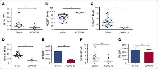 NK-cell quantity and function in severe COVID-19. Absolute NK-cell counts (A), percentage of CD56dim cytolytic NK cells (of total NK cells) (B), and percentage of CD56bright NK cells (of total NK cells) (C) of severe COVID-19 patients were compared with those obtained for healthy controls using Mann-Whitney U statistics. Upon stimulation with erythroleukemic K562 cells, the percentage of degranulating (CD107a+) NK cells (D), degranulation per NK cell expressed as CD107a mean fluorescence intensity (MFI; E), the percentage of IFN-γ (IFN-G)–producing NK cells (F) and IFN-G production per cell (IFN-G MFI; G) in severe COVID-19 patients was also compared. Two-tailed P < .05 was considered statistically significant. *P < .05; **P < .0001. ns, not significant.