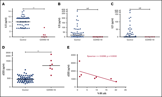 NK-cell–related cytokines and sCD25 in severe COVID-19. Serum concentrations of cytokines involved in NK-cell activation, IL12 (A), IL15 (B), and IL21 (C), in addition to sCD25 (sIL2-Rα; D), in severe COVID-19 patients were compared with those obtained among healthy controls using Mann-Whitney U statistics. Two-tailed P < .05 was considered statistically significant. (E) Association between sCD25 serum concentrations and percentage of NK cells in COVID-19 patients was evaluated by Spearman rank correlation. **P < .0001. nd, not determined (no detectable levels obtained in COVID-19 patients).