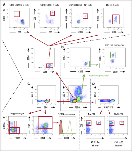 Scheme for immune monitoring. Lymphocyte and monocyte populations were determined by forward scatter height (FSC-H) and side scatter height (SSC-H) levels (inside the central blue square). The former were gated as shown by the red ovals, and the latter were gated as shown by the green squares. (A) In the lymphocyte population, CD45+ cells were plotted according to CD2 (x-axis) and CD19 (y-axis) positivity, and these B cells were gated by quadrant (upper far left panel); also plotted are CD3+ (x-axis) and CD8+ (y-axis) cells, gated by quadrant (upper near left panel); CD16+ (x-axis) and CD56+ (y-axis) natural killer (NK) cells, gated by quadrant (upper near right panel); and CD4+ (x-axis) and CD25+ (y-axis) cells plotted as CD4+CD25+dim-high cells gated by quadrant (upper far right panel). (B) In the monocyte population, CD45+ cells were plotted according to CD20 (x-axis) and CD11c (y-axis) positivity, and CD11c+ monocytes were gated by quadrant. (C) In the lymphocyte population, CD4+ cells were plotted according to FOXP3 (x-axis) and CD45RA (y-axis) positivity (lower left panel). Treg phenotypes of ATL cells were determined based on these data. CD4+ cells are also plotted according to CCR4 expression (x-axis) and CD25 (y-axis) positivity (lower middle panel). CD4 and CD25 double-positive cells are stained with anti-CCR4 monoclonal antibody (open graph) or isotype-control monoclonal antibody (filled graph) to show the level of CCR4 expression in ATL (CD4- and CD25-double positive) cells (lower right panel). (D) Within the lymphocyte population, CD4−, CD13−, and CD19− cells were plotted according to HTLV-1 Tax tetramer (x-axis) and CD8 (y-axis) positivity (lower left panel) or CMV pp65 tetramer (x-axis) and CD8 (y-axis) positivity (lower right panel). These data were obtained from patient number 001.