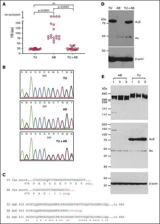 Variability in laser-induced venous occlusion, an fga exon 6 polymorphism and fibrinogen quantity and quality in zebrafish strains. (A) The TTO after laser injury of the PCV in 3-dpf TU (n = 20), AB (n = 18), or TU × AB (n = 19) larvae is represented. The TU strain TTO is significantly shorter than that of AB, but not significantly different (ns) from that measured in TU × AB larvae (Mann-Whitney U tests). Each circle represents an individual larva. (B) Small stretches of Sanger sequencing chromatograms of part of fga exon 6 PCR-amplified from TU, AB, and TU × AB larvae. The sequencing is in the reverse direction to the fga open reading frame. A single-nucleotide deletion can be seen in the AB strain plot, compared with TU, and then heterozygosity at this position in the TU × AB larvae. (C) The consequences of this single-nucleotide change for AαE translation are highlighted. In the top alignment, the sequences begin with the proline 474 codon; the nucleotide deleted in the AB strain is underlined in the TU DNA sequence. Three missense residues are encoded after the deletion in the AB strain (LRR, in gray) before a TAG (UAG in mRNA) terminator. The bottom alignment shows the AαE sequence from the start of the fga exon 6-encoded residues, in TU, AB, and human (Hs) AαE. In AB, translation is predicted to terminate after 27 codons instead of 236 in TU or human AαE. Asterisks (*) show identical aligned residues in TU and human AαE. (D) An immunoblot for detection of zebrafish fibrinogen AαE and β-actin in whole-larvae lysates from 3-dpf TU, AB, and TU × AB larvae in reduced conditions. (E) For further interstrain comparison, additional blots in which 3 independent pools of AB and TU larvae were used are shown.