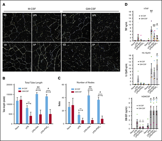 M-CSF regulatory macrophages promote angiogenesis and GM-CSF macrophages promote inflammation in vitro. Human monocytes were cultured in M-CSF or GM-CSF for 7 days and then were left unstimulated or were stimulated with LPS, LPS + Ado, or LPS + PGE2 for 24 hours at which point supernatants were collected for further studies. (A) Cell tube formation in HUVECs was observed after 24-hour exposure to supernatants harvested from stimulated M-CSF and GM-CSF macrophages from 1 representative donor (n = 3 donors total). Representative images were captured by brightfield microscopy with “find edges” contrast applied in ImageJ to be able to see the tubes. (B) Total tube length was measured in pixels manually using ImageJ software on various images of HUVECs exposed to supernatants of macrophages from multiple donors (n = 3). **P ≤ .01; ****P ≤ .0001 between M-CSF and corresponding GM-CSF samples; #P ≤ .05; ##P ≤ .01 for M-CSF samples relative to unstimulated (NS) supernatants. (C) The number of nodes, defined as 3 or more tubes originating from 1 point, was counted manually using ImageJ software on various images of HUVECs exposed to supernatants of macrophages from multiple donors (n = 3). **P ≤ .01; ****P ≤ .0001 between M-CSF and corresponding GM-CSF samples; #P ≤ .05; ##P ≤ .01 for M-CSF samples relative to NS supernatants. (D) Levels of inflammatory cytokines, TNF, IL12p40, and GM-CSF, in the supernatants of stimulated macrophages were measured by ELISA (n = 5-9). *P ≤ .05 relative to LPS stimulation alone; #P ≤ .05; ##P ≤ .01 for GM-CSF relative to corresponding M-CSF samples. Error bars represent SEM.