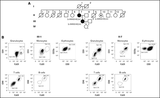 Pedigree of the family and GPI-AP-deficiency of the patient and her mother. (A) Pedigree. Family members tested are indicated by an asterisk. The patient (III-1) and her mother (II-7) have a PNH clone. The aunt (II-10) has a heterozygous PIGB mutation c.695G>A but no PNH clone. The daughter (IV-1) and uncle (II-11) have no PIGB mutation. (B) Flow cytometry of blood cells from the patient (III-1) and her mother (II-7).